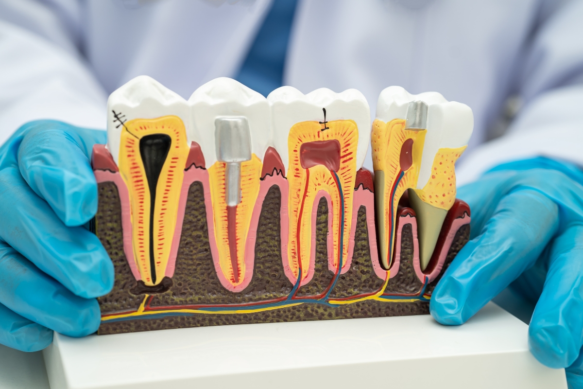 Dental Implants Richmond